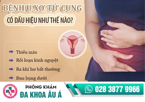 u xơ tử cung